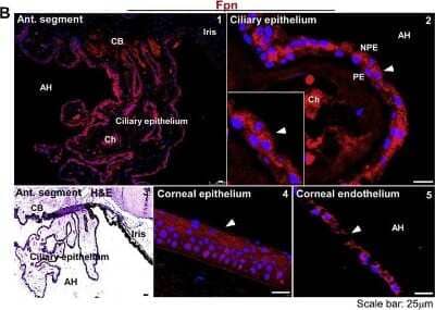 Immunohistochemical Staining of Ferroportin/SLC40A1 in Human Eye Segment